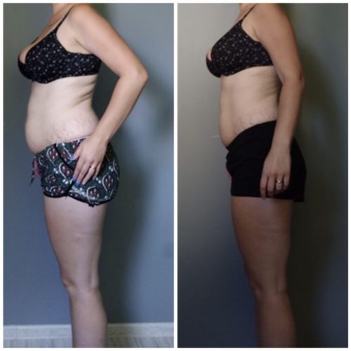 Metamorfoza wylwetki 1