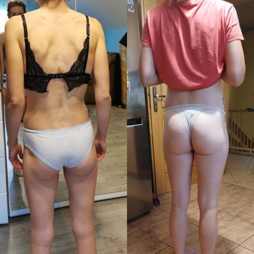 Metamorfoza wylwetki 3